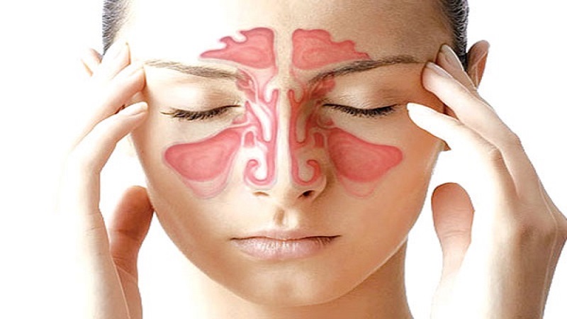 নাক বন্ধ মাথাব্যথা ও সর্দি কিসের লক্ষণ, কী করবেন?